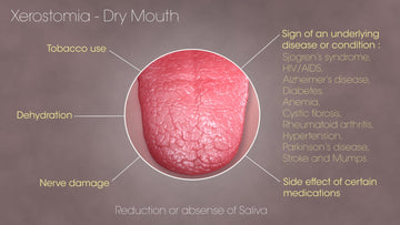 Dry Mouth aka Xerostomia
